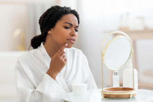 [Skincare] What is Acne?